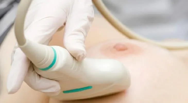 ¿Conoces principales síntomas cáncer de mama?