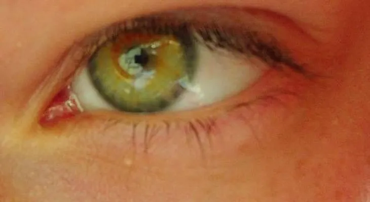 Cómo elaborar una crema para eliminar ojeras y bolsas
