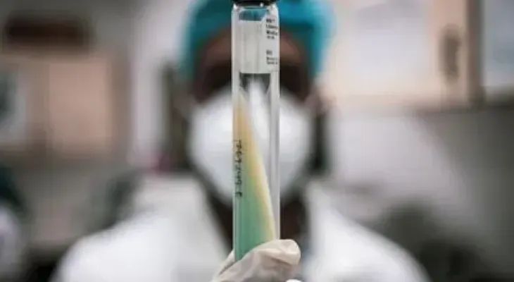 La pandemia del coronavirus disparó las muertes por tuberculosis en 2020 