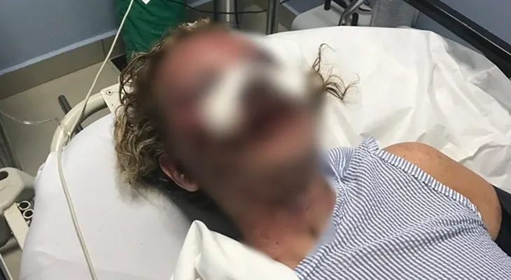Embajada de EEUU sigue de cerca caso de turista agredida en hotel de Punta Cana