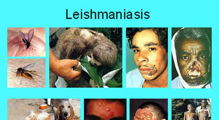 Leishmaniasis: una enfermedad infecciosa que afecta cerca de tres millones de personas
