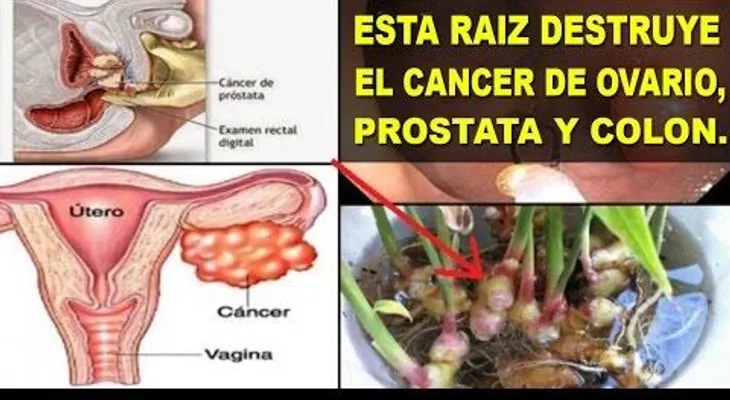 Esta poderosa raíz destruye el cáncer de próstata, ovarios y colon (VIDEO)