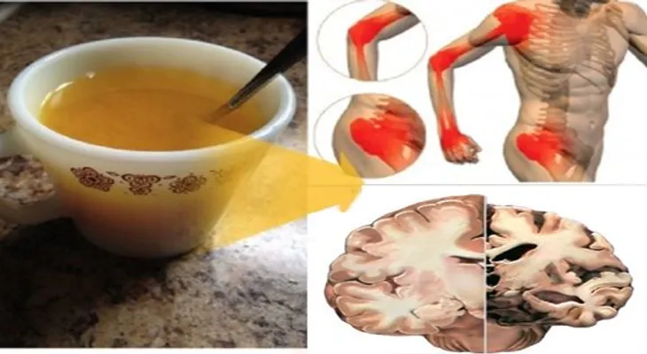 10 razones para beber agua de cúrcuma caliente todas las mañanas