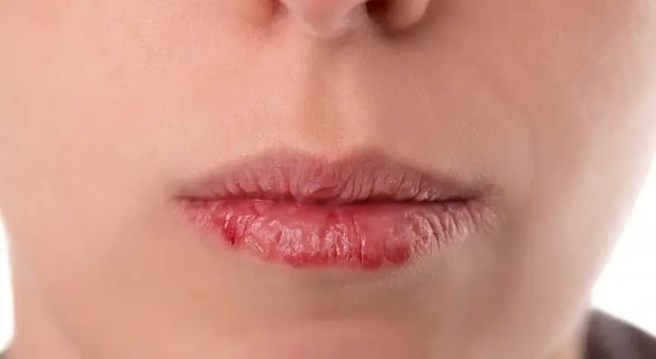 Si estás perdiendo el cabello o tienes la piel reseca es porque te falta 1 de estas vitaminas