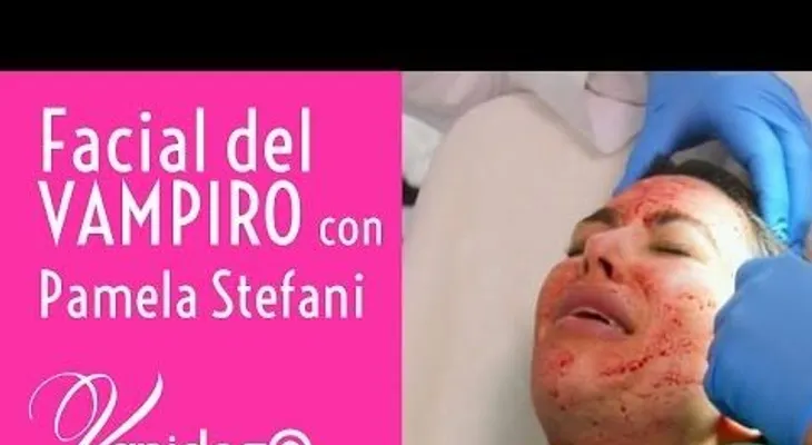 Rejuvenecimiento: "el facial del vampiro"...Video: VanidosoTV Facial del Vampiro - Pamela Stefani