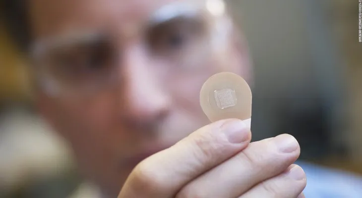 Un parche cutáneo podría ser el futuro de la vacuna contra la gripe, dice este estudio