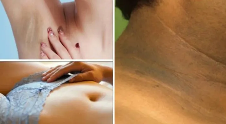 Mis rodillas, cuello y axilas estaban negras, con esto las blanqueé en 5 días