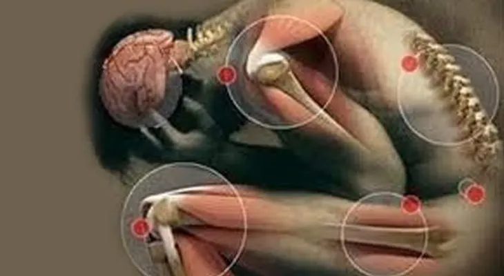 ¿Es la osteoartritis un problema metabólico? 