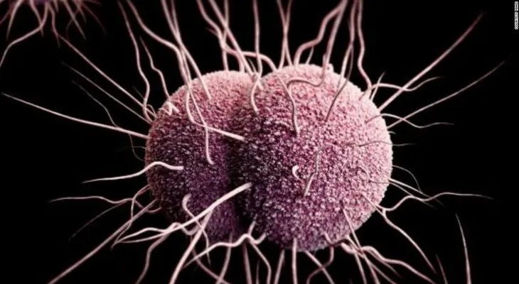 Esta enfermedad de transmisión sexual se está volviendo cada vez más 'inteligente' y más difícil de tratar