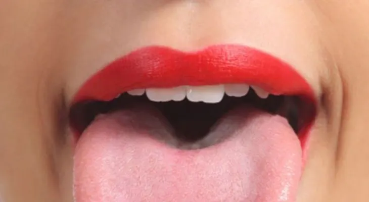 Tenía una capa blanca sobre su lengua, pero por suerte fue al médico justo a tiempo 