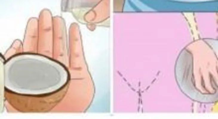 Manten al día tu higiene femenina y elimina las infecciones por hongos con aceite de coco