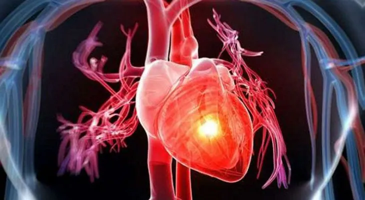 Diferencia entre un ataque de pánico y un ataque del corazón
