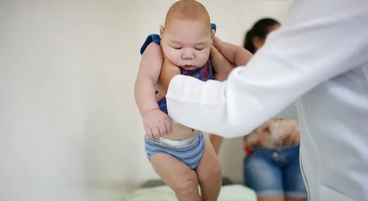 Más de 580 bebés fueron diagnosticados con microcefalia en Brasil
