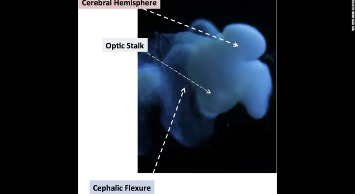 Científicos crean mini cerebros casi completamente humanos