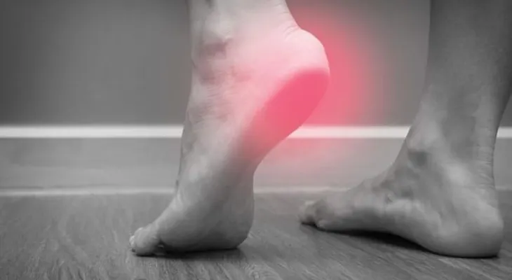 Causas del dolor de talón y como aliviarlo naturalmente