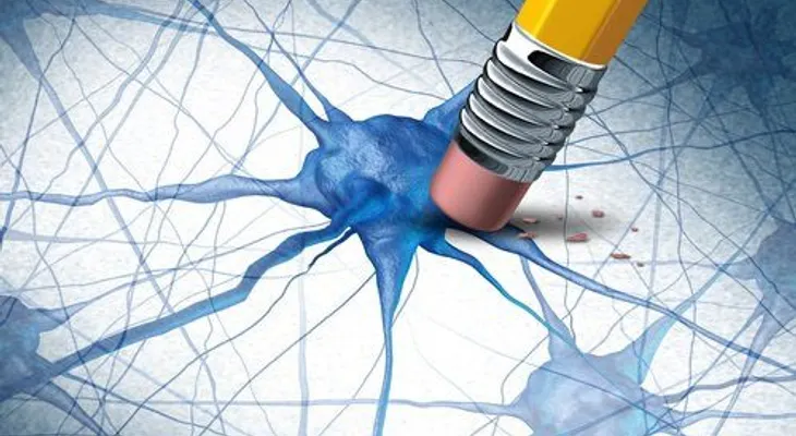 Cómo saber si padeces de Alzheimer