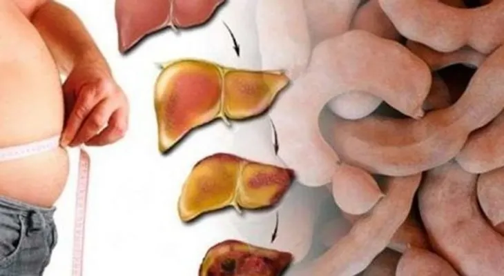 Mira lo que una sola fruta puede hacer por tu higado. Es increíble 