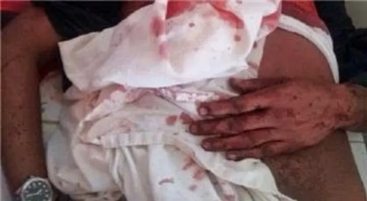 Matan a golpes ganadero Alberto Antonio Cabrera, de 64 años 