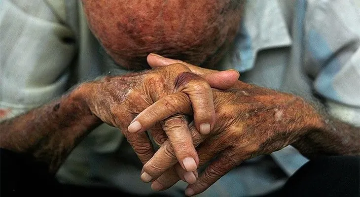 España inicia la expulsión de ancianos con papeles a los que niega la tarjeta sanitaria