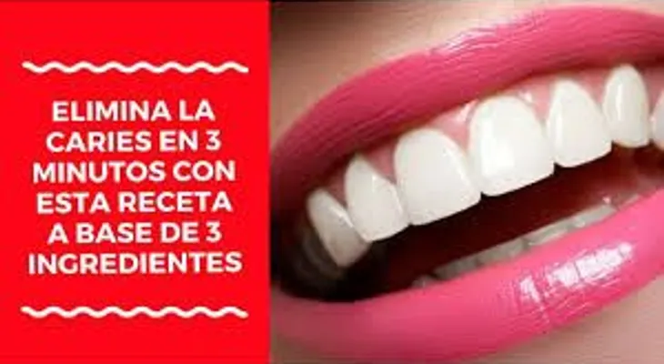 El truco para eliminar la caries en solo 20 minutos, que un odontólogo NUNCA te dirá 