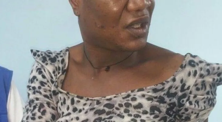 Hombre le propina disparo a homosexual haitiano al descubrir que no era una mujer