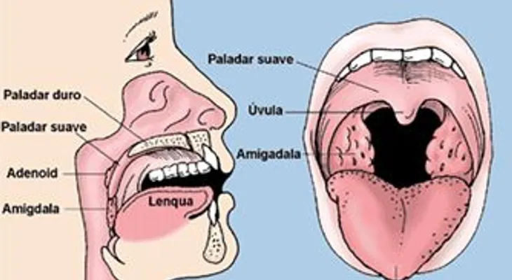 Remedios naturales para las adenoides: DR. Wilfredo Mañón