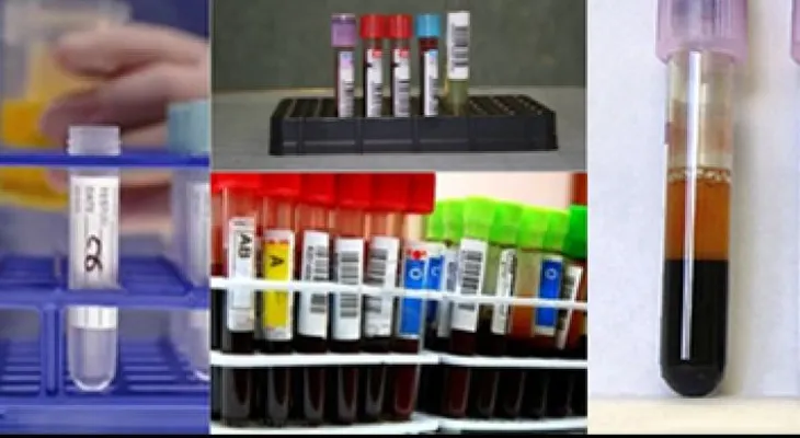 ¡Crisis! Laboratorios reciclan tubos de ensayo por escasez de insumos