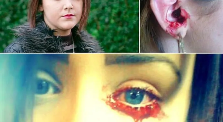Una joven sangra por los ojos y oídos y nadie sabe la razón