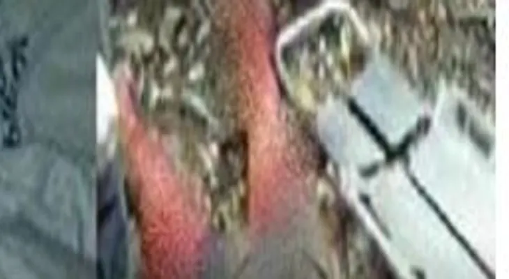 Un haitiano le propina 20 machetazos a una menor y le amputan las dos piernas; se debate entre la vida y la muerte 