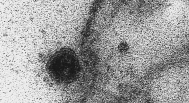 El momento exacto en que el coronavirus infecta una célula