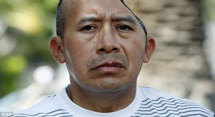 Hombre perdió parte de su cabeza recibe millonaria indemnización
