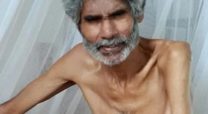 Hombre pasa 100 días en huelga de hambre en Trinidad y Tobago 