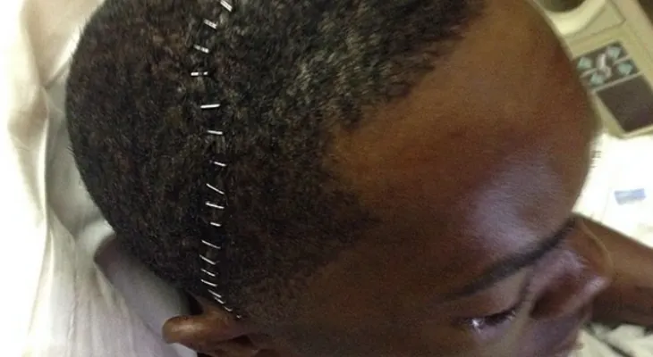 Video: Aroldis Chapman recibe pelotazo en la cara