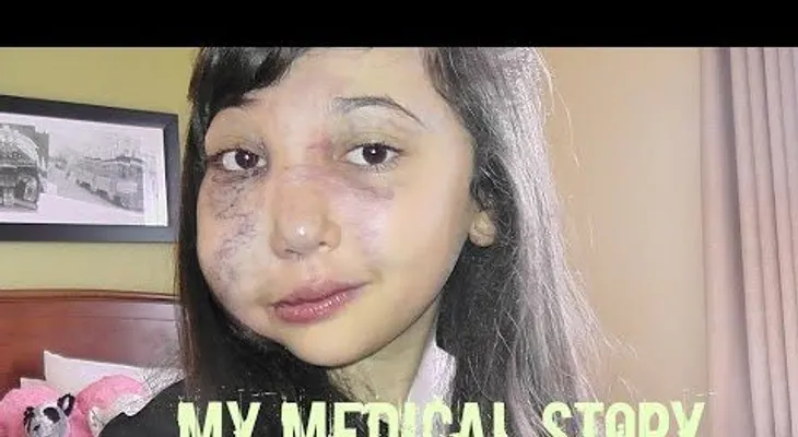 Una niña youtuber con una enfermedad rara emociona (VIDEO)