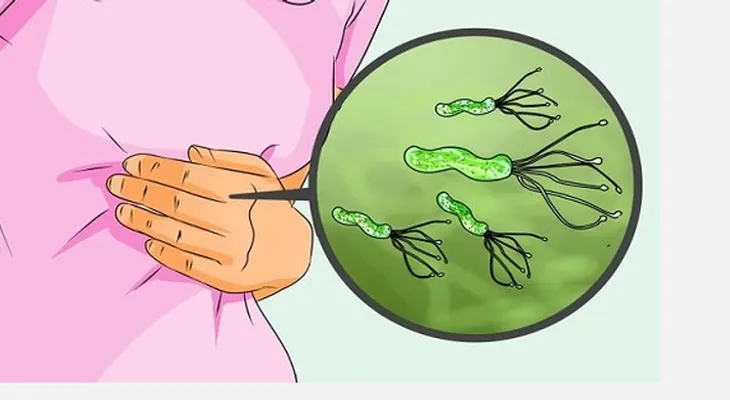 Médico Japonés revela como matar de raíz bacteria de Helicobacter Pylori