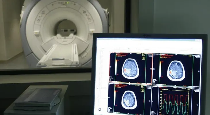 Descubren una nueva alteración en el cerebro de las personas con alzheimer