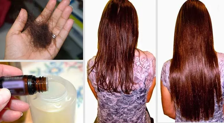 Pon estos dos ingredientes a tu champú y despidete de la caída del cabello de por vida 