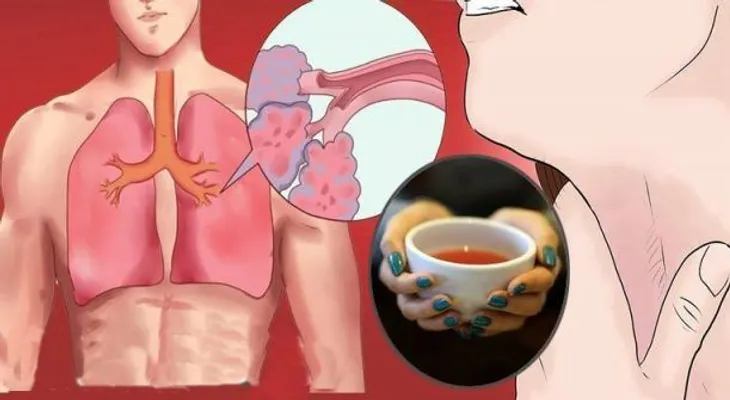 ¡Este poderoso té cura el asma de manera sorprendente!