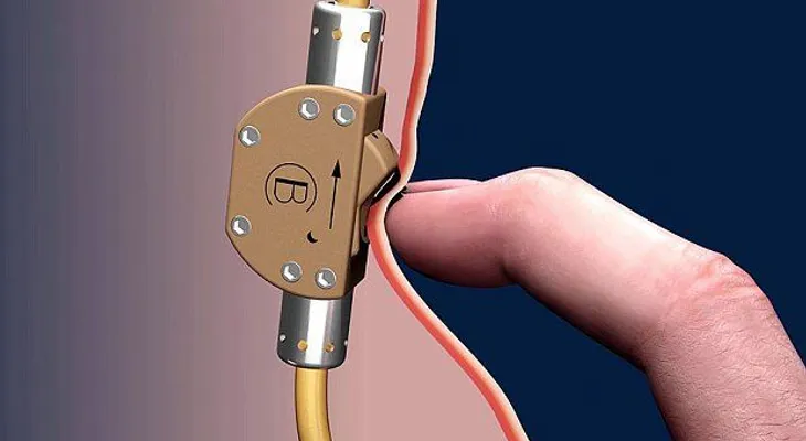 Este simple switch permite al hombre decidir si la embarazas o no (VIDEO)