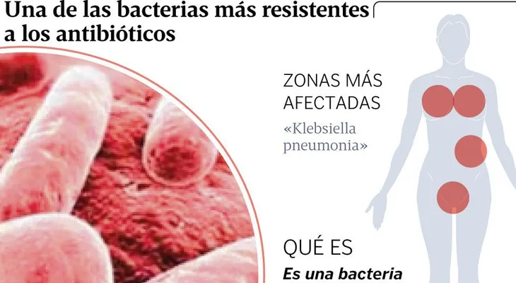 La "Klebsiella": Se puede pegar por contacto en hospitales y causar enfermedades mortales