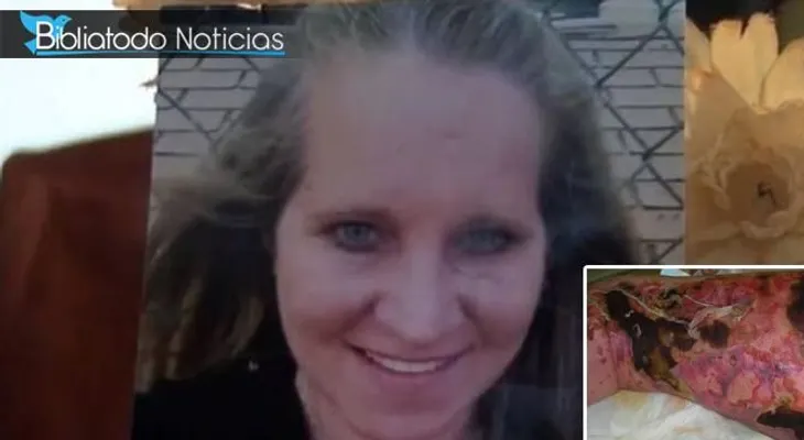 Mujer muere luego de contraer el virus "Come Carne en una playa de EE.UU