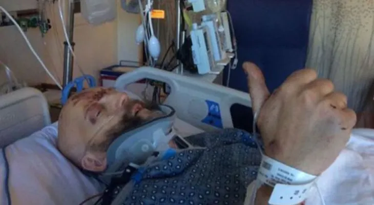 Un actor de Harry Potter está en grave estado tras un violento accidente de tránsito