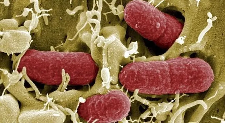 Bacteria resistente a antibióticos mata a 4 personas en Brasil