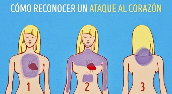 Cómo reconocer un ataque al corazón un mes antes de que suceda