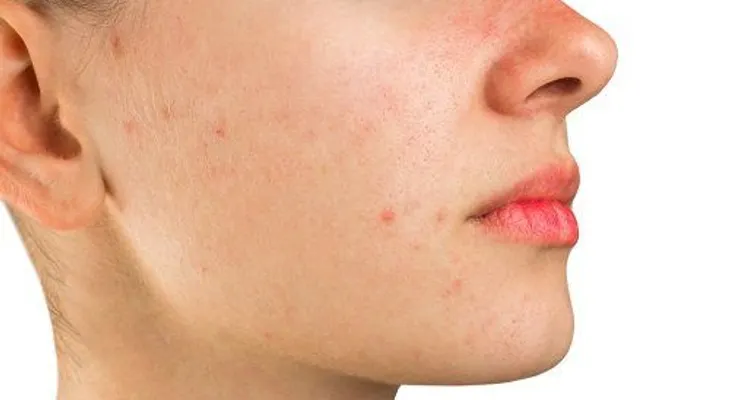 Observa las consecuencias de dormir con maquillaje. No querrás hacerlo nunca más