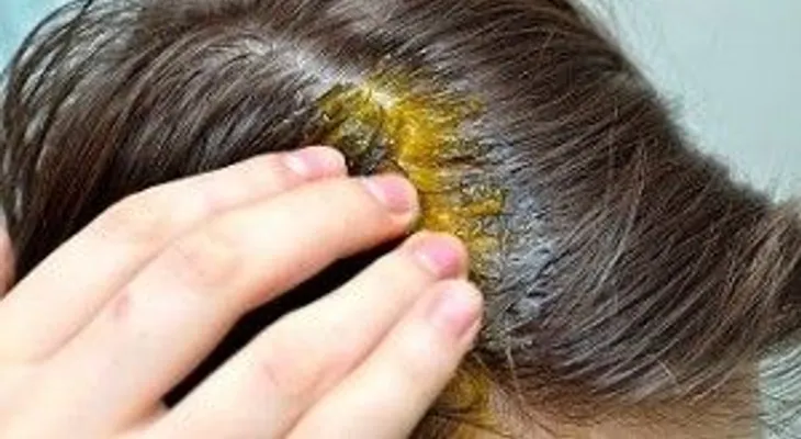 5 consejos efectivos para evitar la caída del cabello
