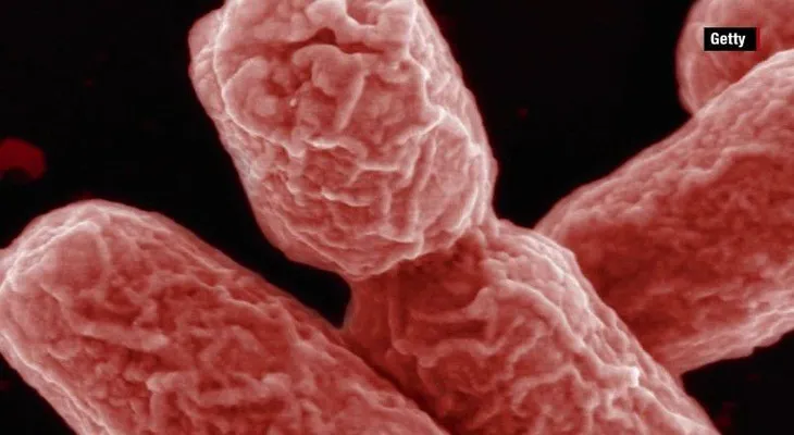Brote de gonorrea en Hawaii muestra aumento de resistencia a los antibióticos