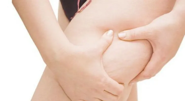 Bebidas para eliminar la terrible celulitis