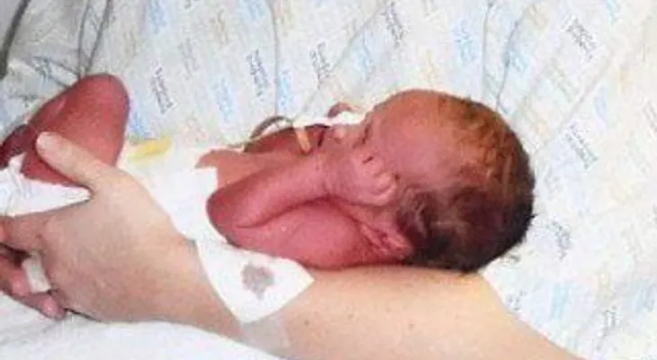 Mujer con dos vaginas dio a luz a dos niños