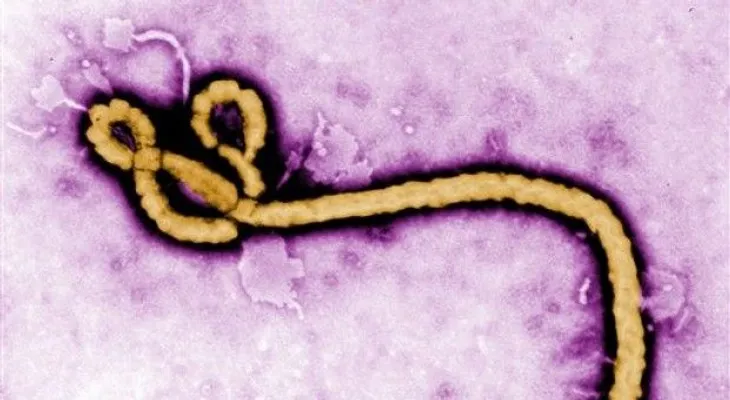 Detectan ébola en el ojo de un paciente curado 